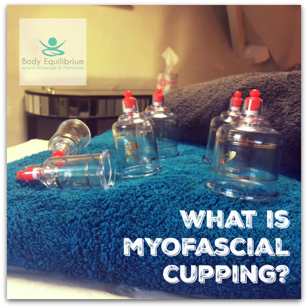 What Is Myofascial Cupping Body Equilibrium Sports Massage And Therapies In Daventry